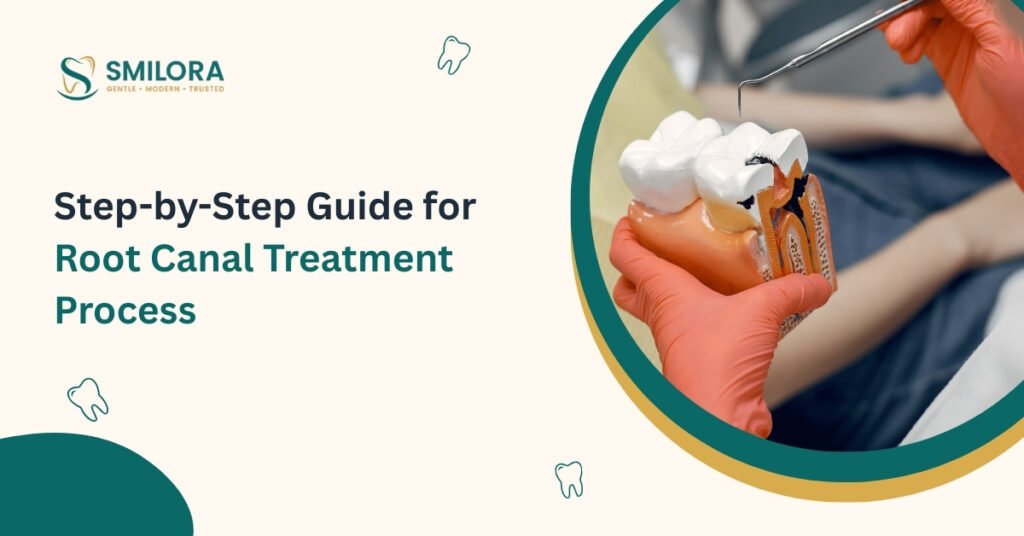 Step-by-Step Guide for Root Canal Treatment Process