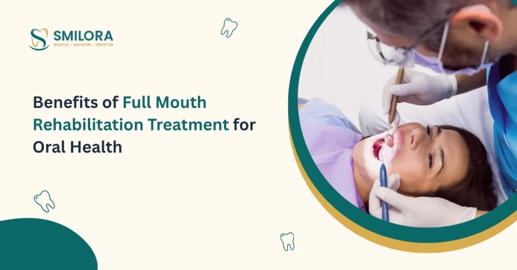 Benefits of Full Mouth Rehabilitation Treatment for Oral Health