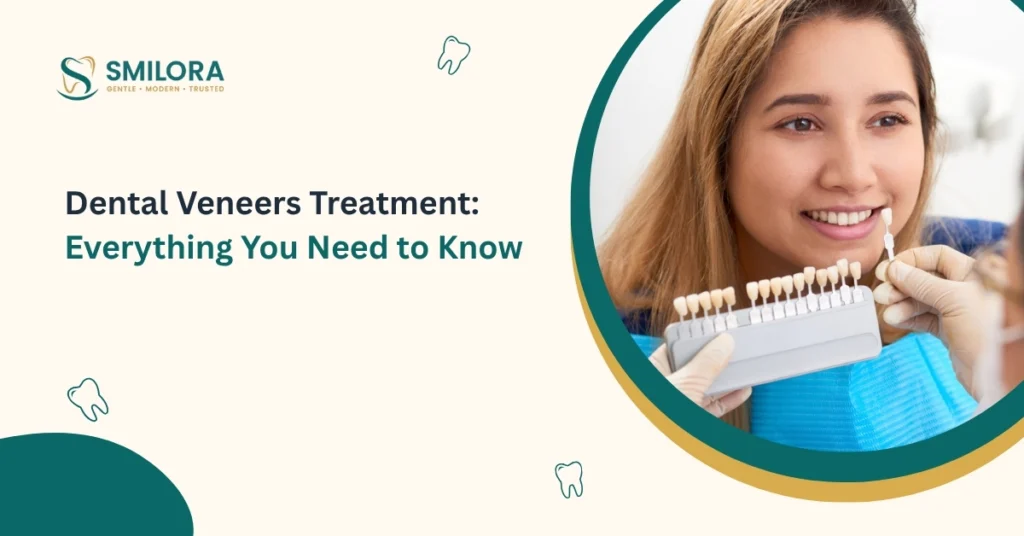 Dental Veneers Treatment_ Everything You Need to Know