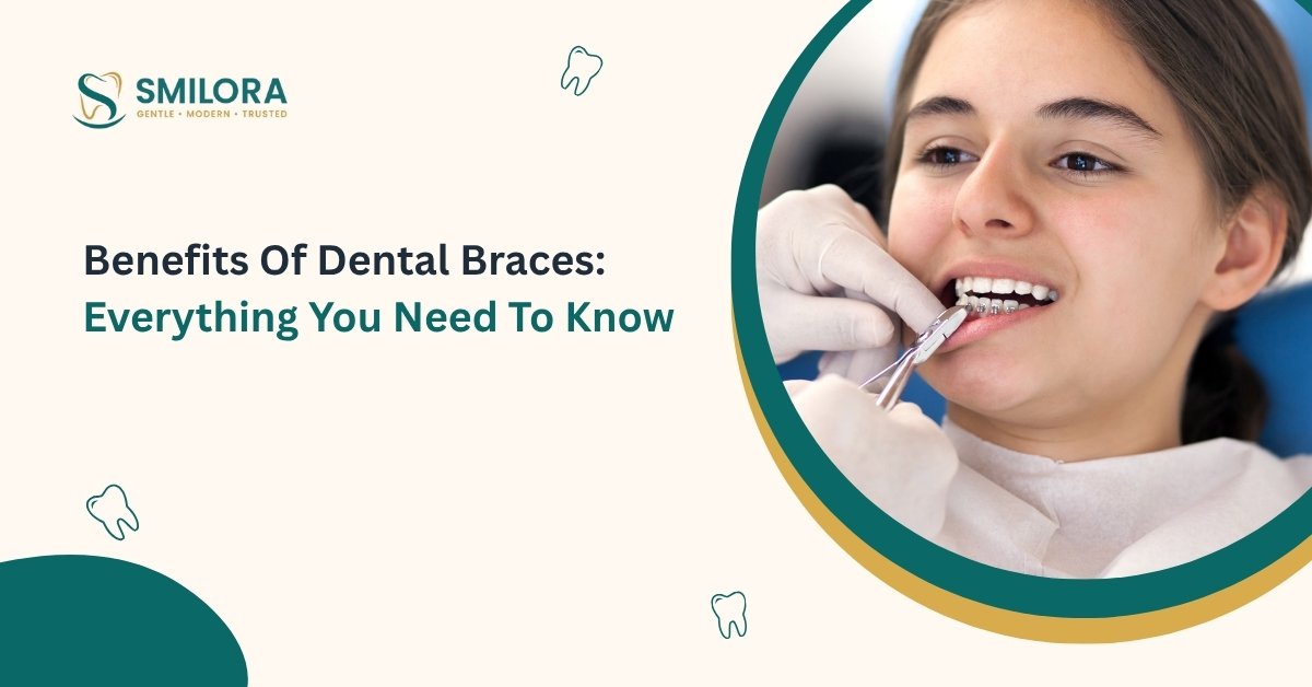 braces treatment in Chembur