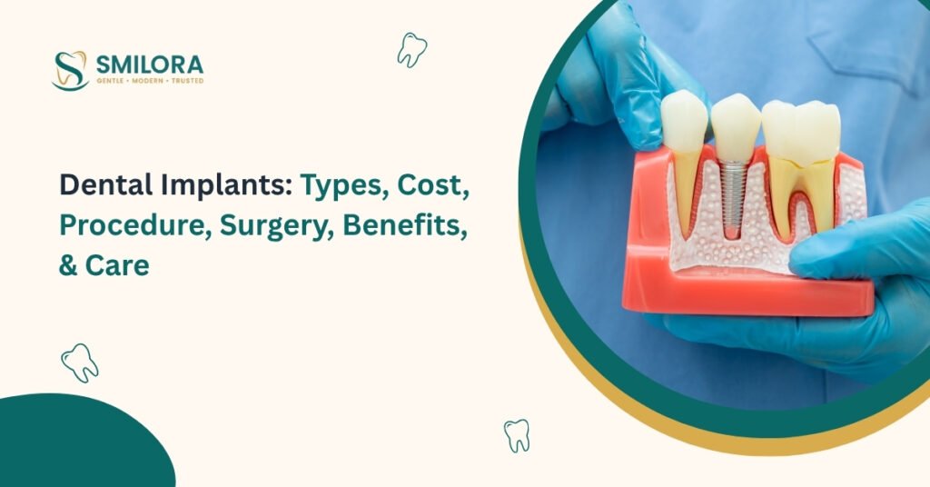 Dental Implants Types, Cost, Procedure, Surgery, Benefits, & Care