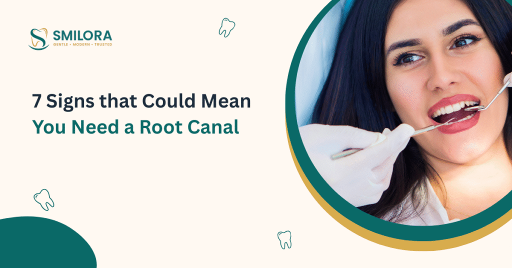 Signs that Could Mean You Need a Root Canal