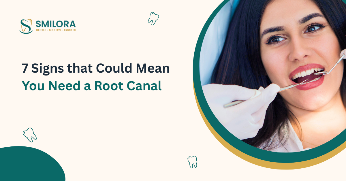 Signs that Could Mean You Need a Root Canal