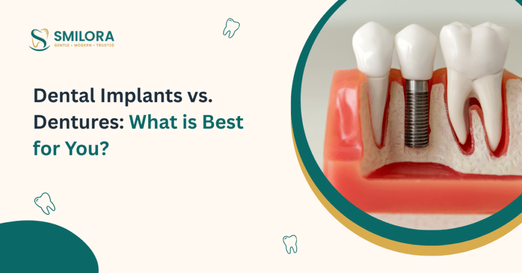 Dental Implants vs. Dentures