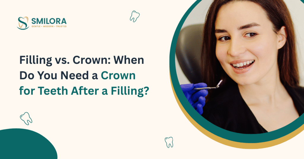 When Do You Need a Crown for Teeth After a Filling
