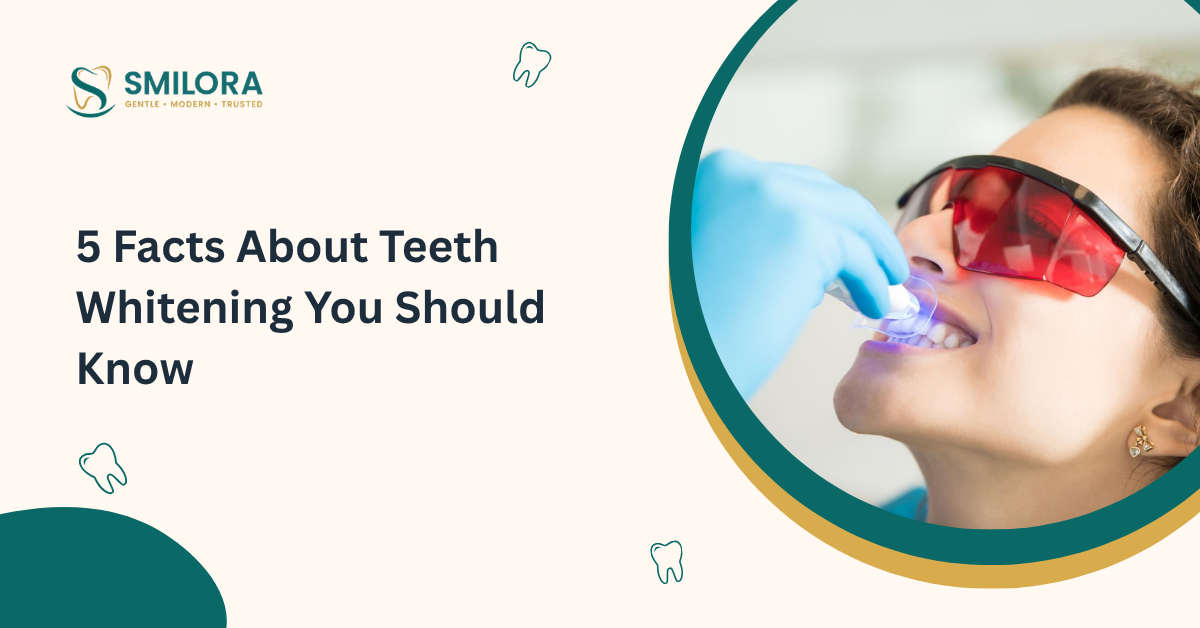 5 Facts About Teeth Whitening You Should Know