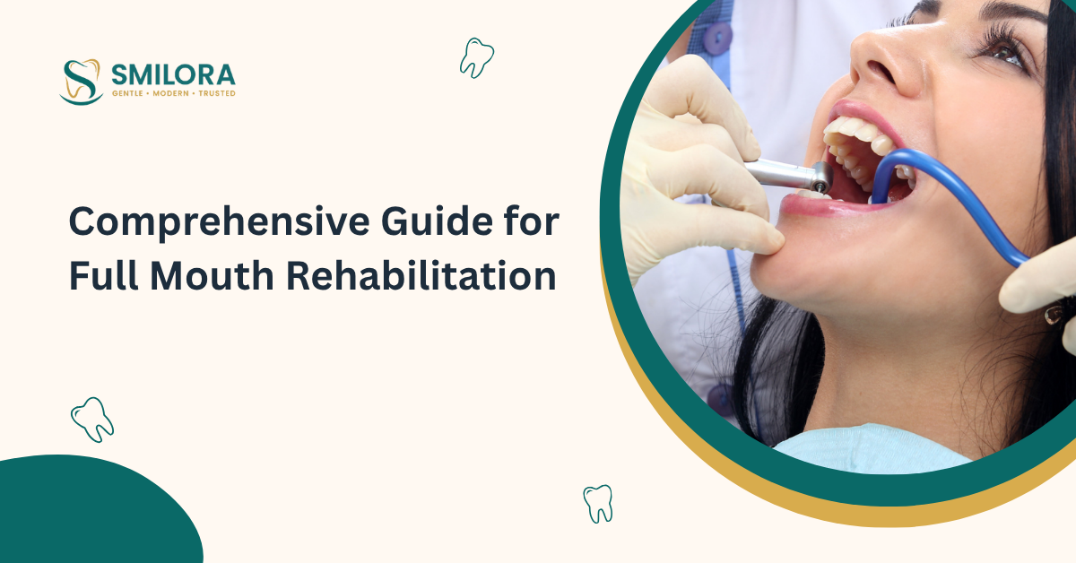 Comprehensive Guide for Full Mouth Rehabilitation