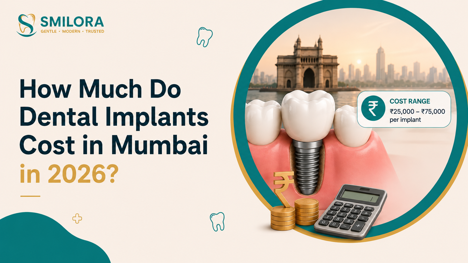 Dental implant cost in Mumbai 2026 infographic showing dental implant procedure, pricing range, and modern dental treatment concept