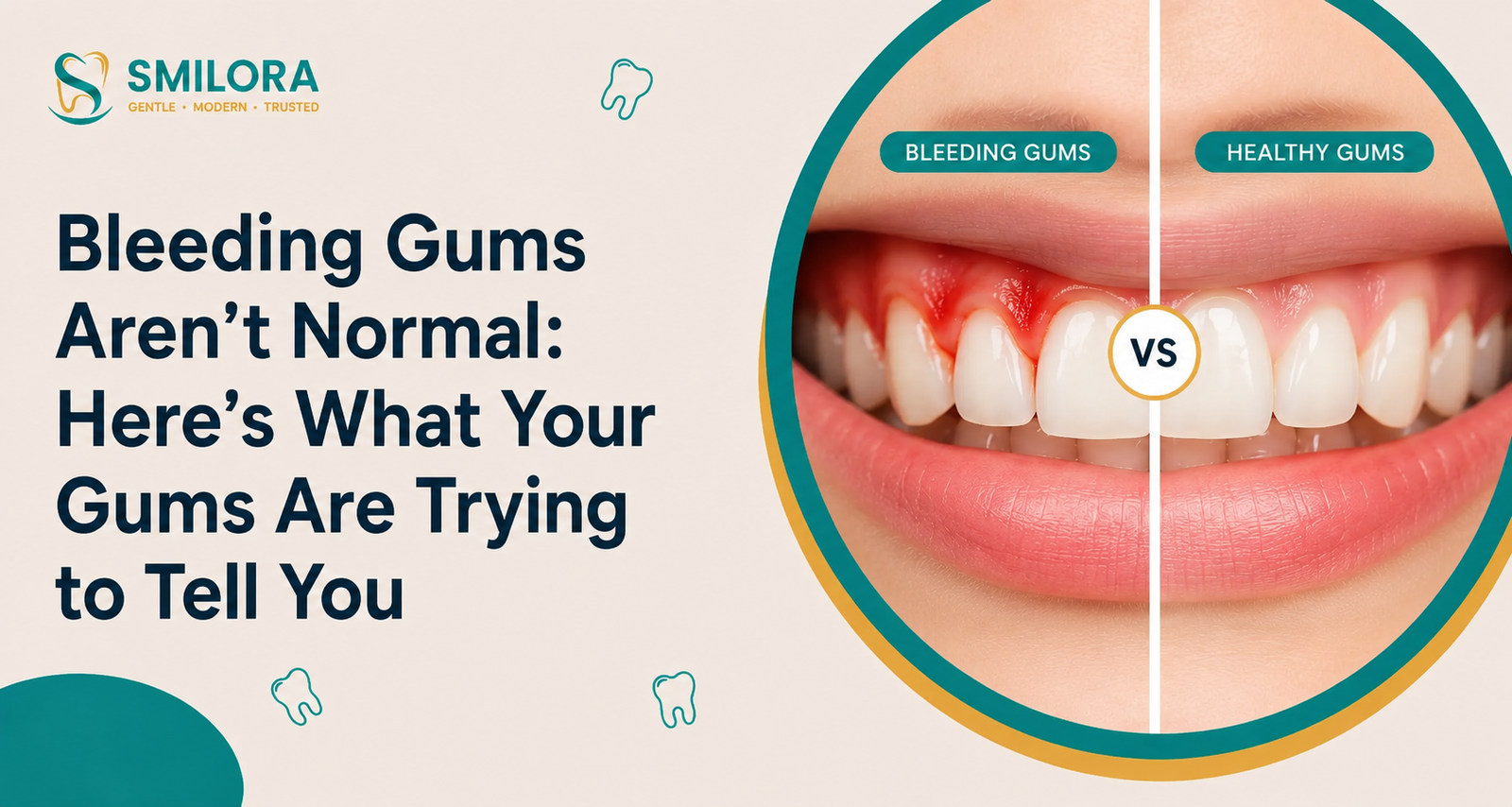 Bleeding gums vs healthy gums comparison showing early signs of gum disease and healthy teeth for better oral health awareness.