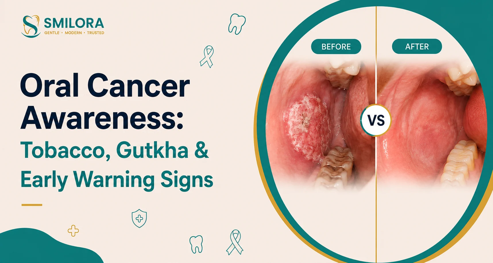 SMILORA Oral Cancer Awareness poster highlighting tobacco, gutkha, and early warning signs with a before-and-after mouth comparison in a teal and gold medical-themed design.
