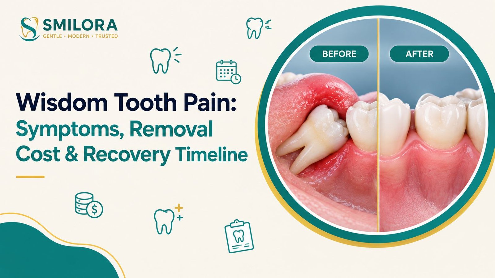 wisdom_tooth_pain