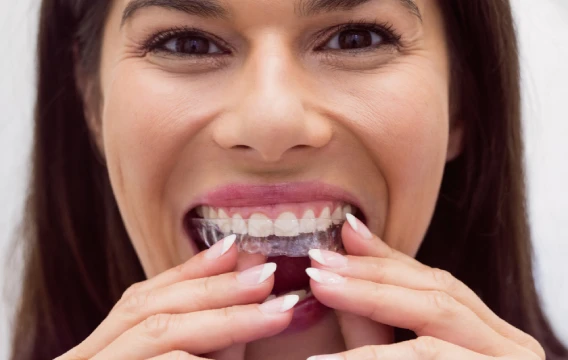 Invisible Aligners in Chembur Invisible Aligners in Chembur