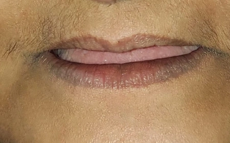 Before Before