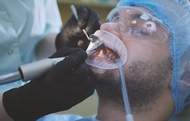 Fluorosis Treatment in Chembur Fluorosis Treatment in Chembur