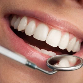 smile design to implants smile design to implants